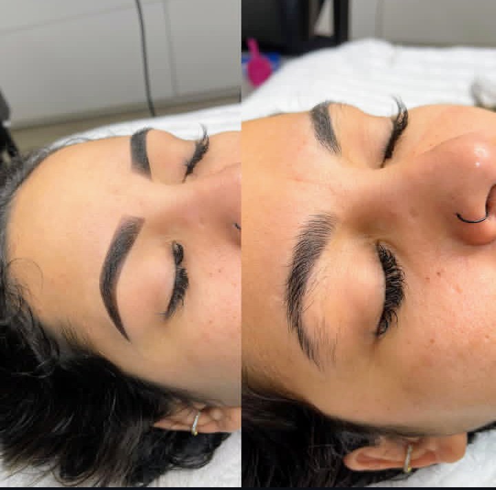 Imagens de Antes de Depois de Clientes