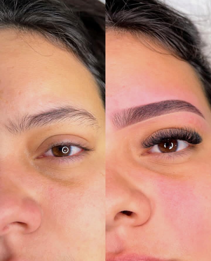 Imagens de Antes de Depois de Clientes