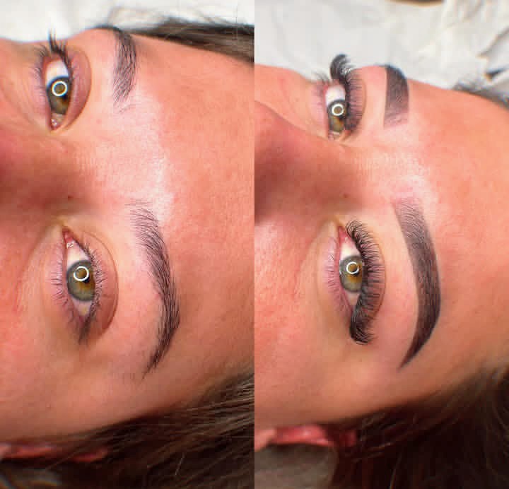 Imagens de Antes de Depois de Clientes