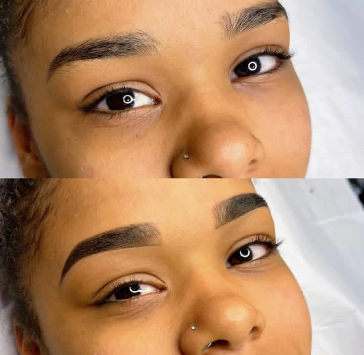 Imagens de Antes de Depois de Clientes