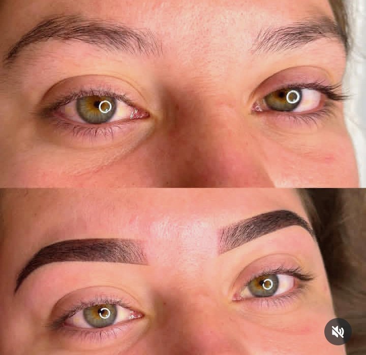 Imagens de Antes de Depois de Clientes