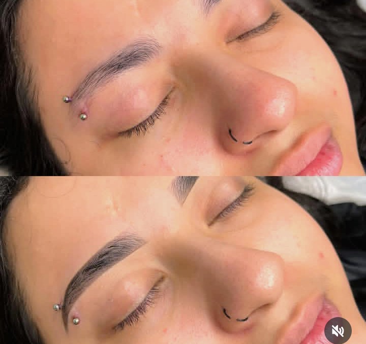 Imagens de Antes de Depois de Clientes