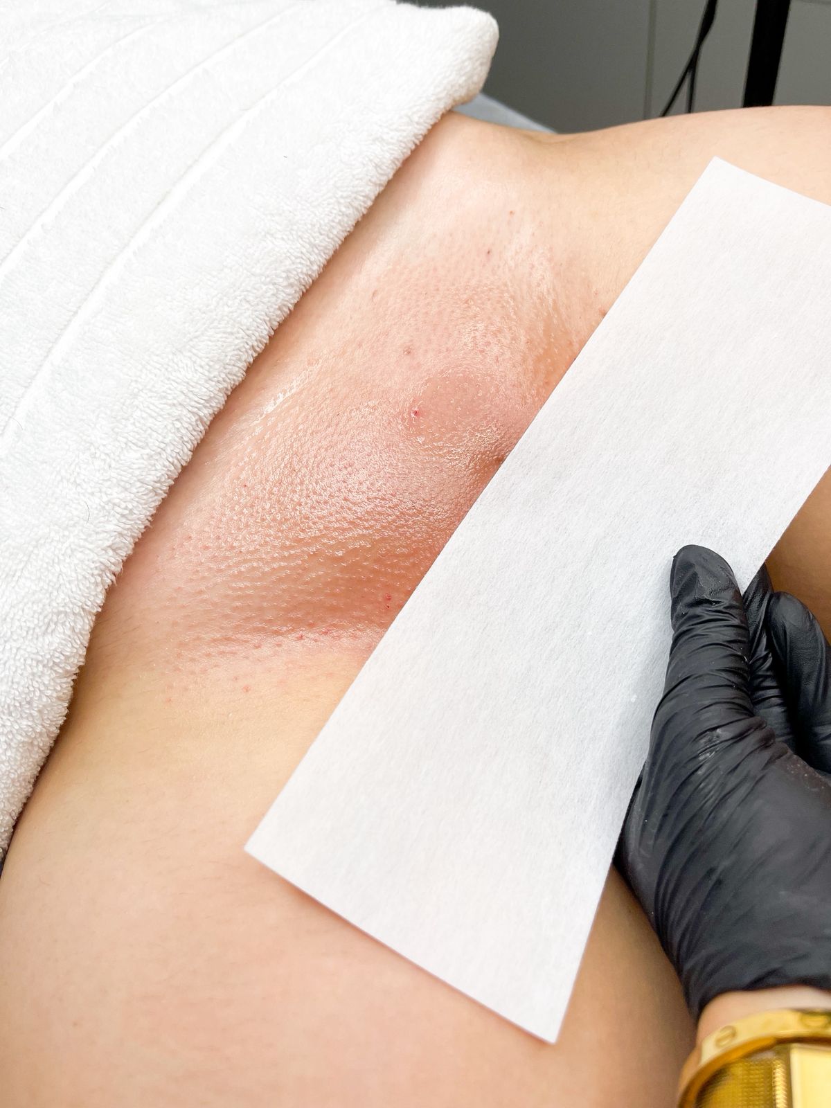 Imagem de uma região do corpo depilada.